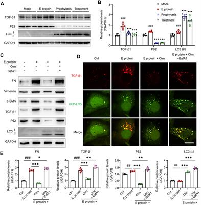 Olmesartan alleviates SARS-CoV-2 envelope protein induced renal fibrosis by regulating HMGB1 release and autophagic degradation of TGF-β1